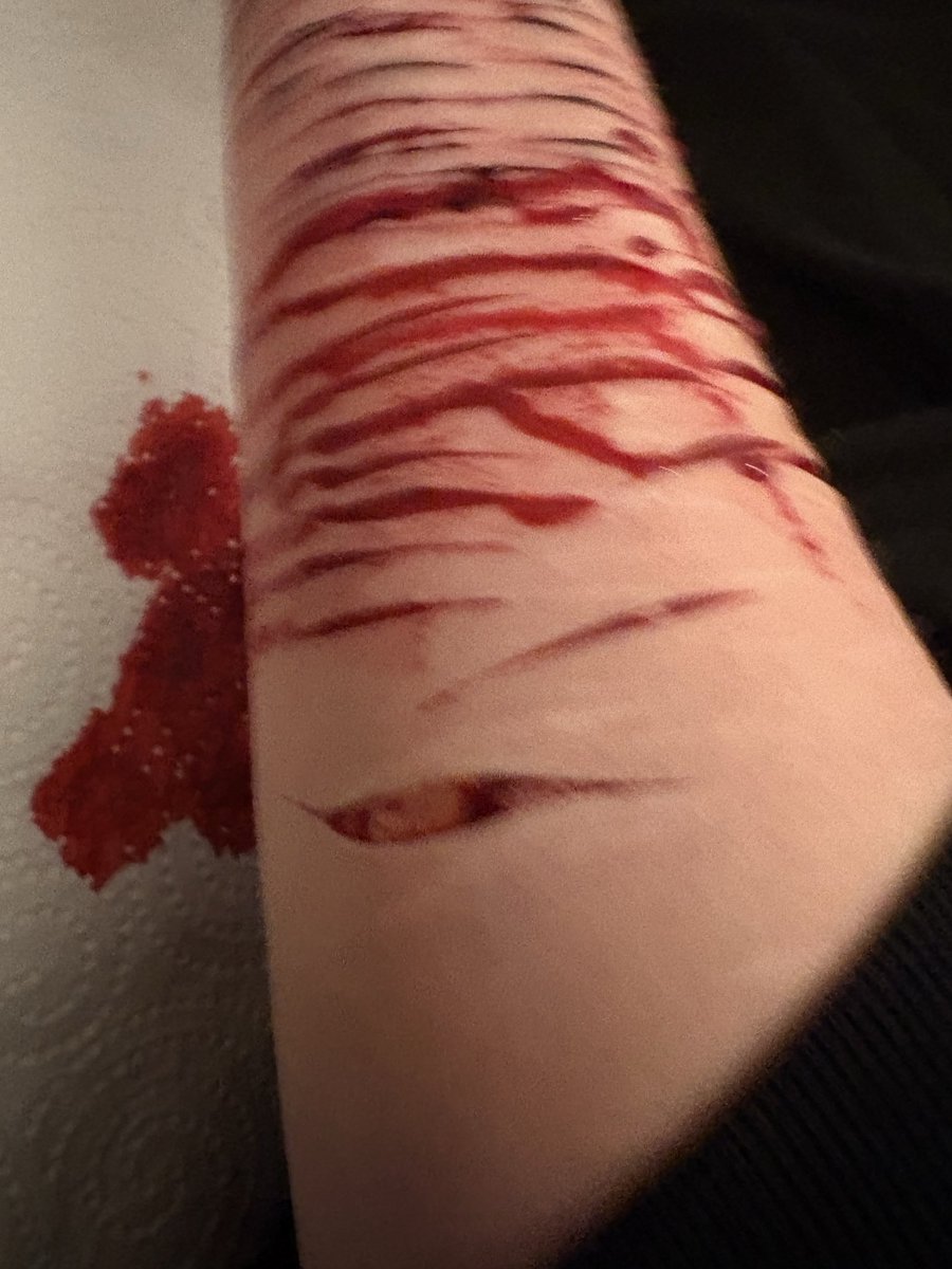cloudyykittyy's tweet photo. #svwtw

its fale blood!!!  ALL SFXXX!!! https://t.co/jr6EiydoER