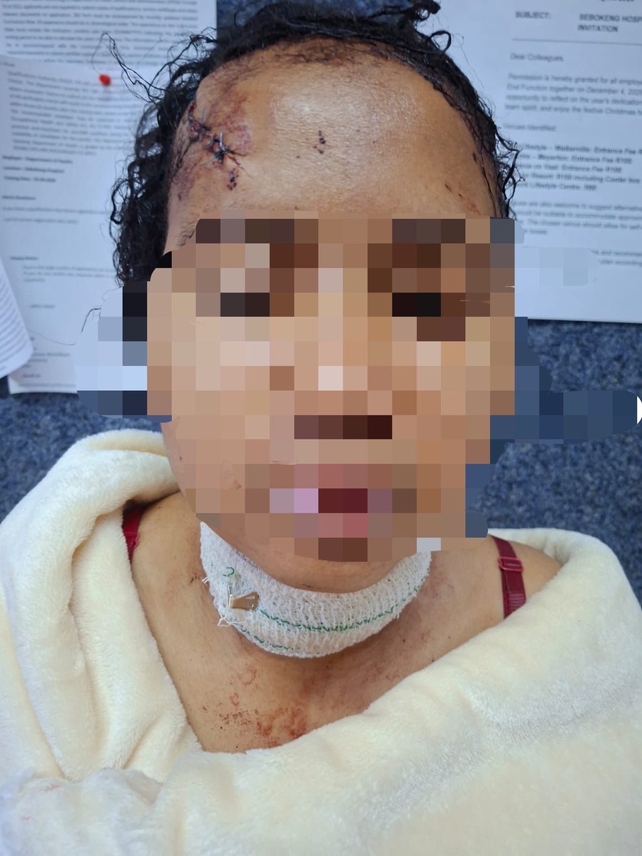 Lee_Raa_Tuu's tweet photo. This is a family member who was stabbed by her boyfriend earlier today because she wanted to end the relationship. He stabbed her on the head multiple times and tried to cut her throat. She managed to run to the neighbours house and collapsed. The neighbour managed to rush her to the nearest clinic where she was immediately rushed to the nearest hospital. The boyfriend is alleged to be a nurse at a hospital in Sebokeng. 

With all the killings of women happening in South Africa 🇿🇦, he dares tried to unalive such a beautiful young woman in her own home. @SAPoliceService WHAT ARE YOU DOING WITH ALL THESE HAPPENING TO WOMEN❓
@GovernmentZA WHY ARE YOU SO QUIET ❓
@CyrilRamaphosa YOUR SILENCE IS SO LOUD😭‼️
