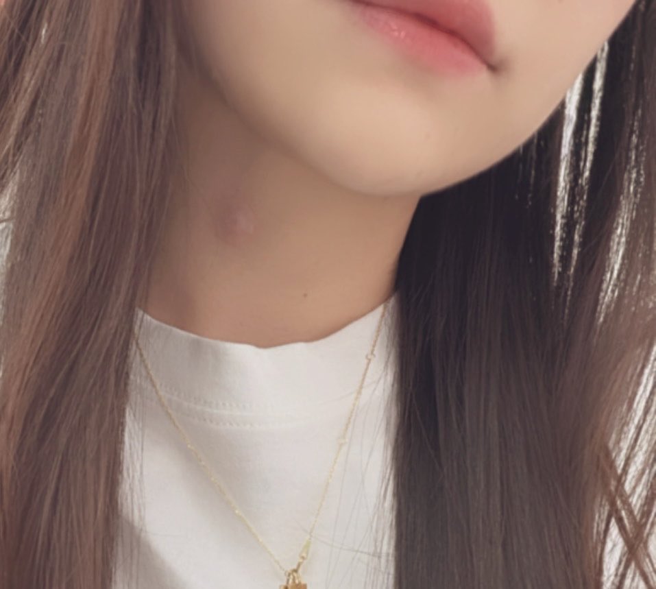 mmmo9c's tweet photo. 顔以外が荒れだしたらストレスピークの証拠なタイプ🙃
今日は疲れる日なのわかってるから好きな珈琲屋さん朝一行ってモチベあげて仕事頑張る😮‍💨 https://t.co/Y0uJAvA9P5