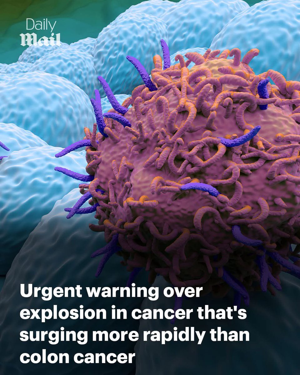 toobaffled's tweet photo. We all know, even the ones still pretending they don't ‼️‼️

Appendix cancer just quietly quadrupled in millennials.
Faster rise than colon cancer. One in three cases now under 50. Official answer: “we’re baffled.”

Same story every time a new cancer starts hitting younger people. Count the cases. Ignore the cause. Call it a mystery. Move on.
Rare yesterday. Not rare enough today.