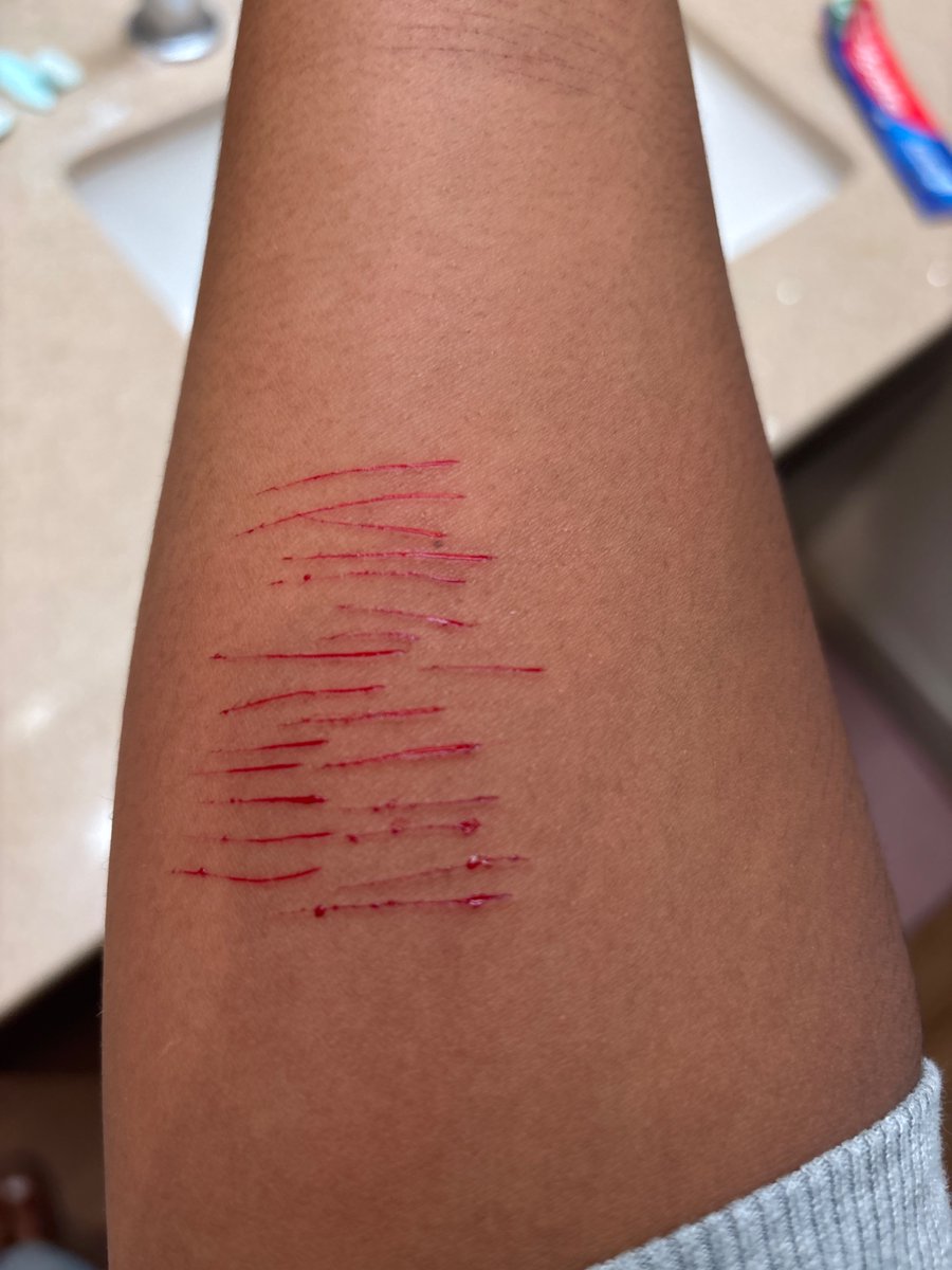 MMickaLoves's tweet photo. THIS IS FAKE MAKEUP! I HAD THE HELP FROM AI!! #cutspo #bloodspo #scarspo #shtwt https://t.co/tIt8K3DcML