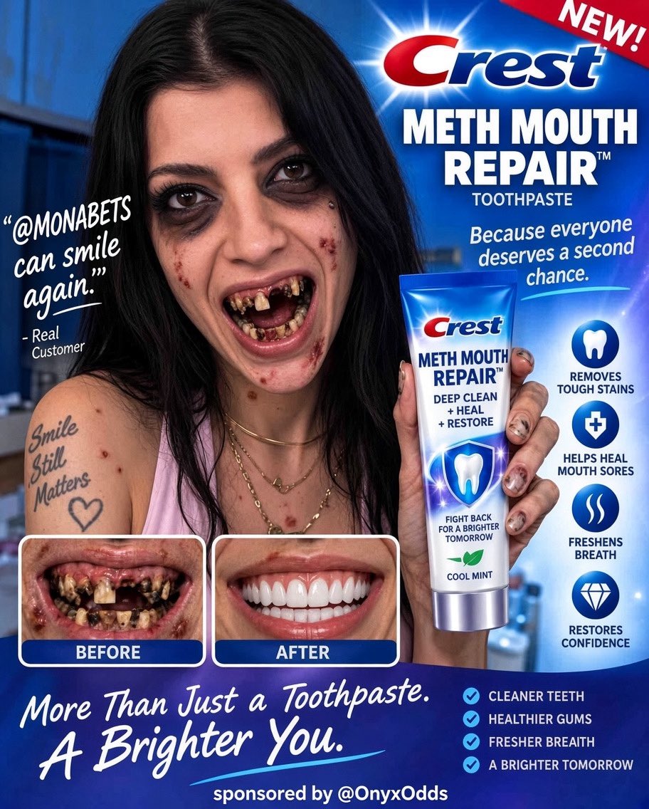 mona_bets's tweet photo. 🦷 sponsored by @OnyxOdds https://t.co/H9U02STM2g