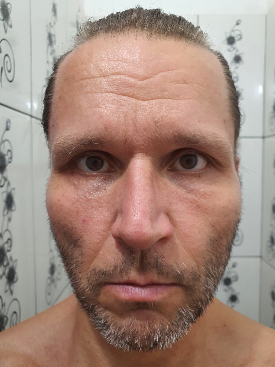 SalomonRejuven's tweet photo. ๐ฅ I found the fountain of youth of the emperors.
Day 4647 Age 54 โ reversing into low 40s.
No filters. No shortcuts. Just biology reactivated.
Goal: 25.
I post daily until I get there. Watch closely.
๐ช
#RejuvenationBodybuilding #ReverseAging #Longevity #Shredded https://t.co/sSu3GT734o