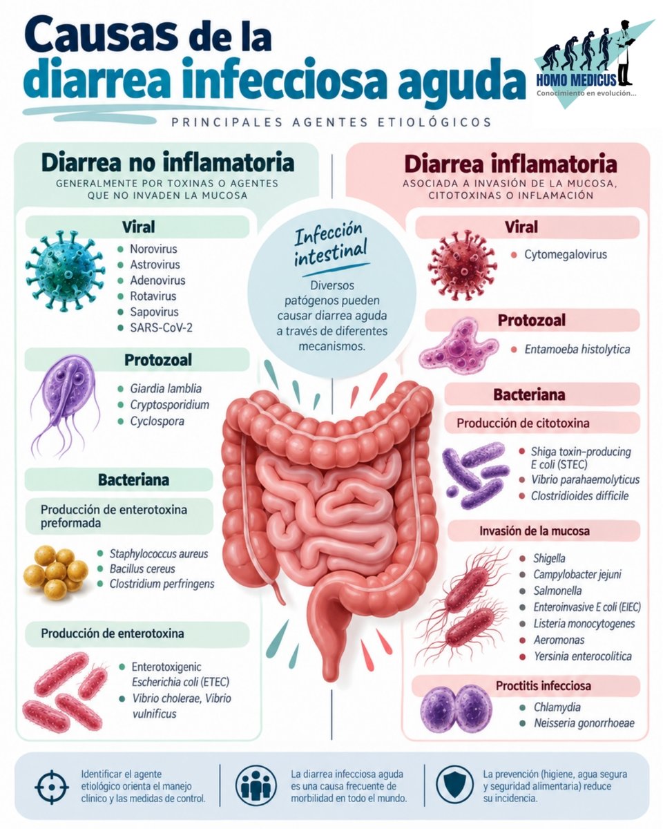 ENARM_intensivo's tweet photo. 📌CAUSAS DE LA DIARREA INFECCIOSA AGUDA

#ENARM_INTENSIVO #ESTUDIA_MEDICINA https://t.co/2A67xLii8e