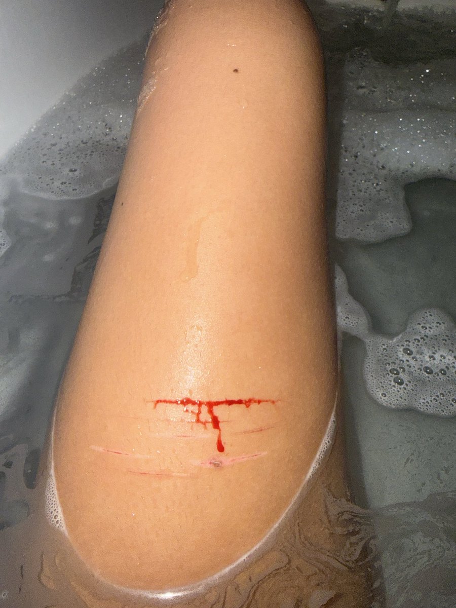 rubylevelledup's tweet photo. bb cut sesh :3 i love cutting in the bath
#shtwt #slittwt #shedtwt #fruitninja #slashflash #sh https://t.co/v0RYa5ClUc