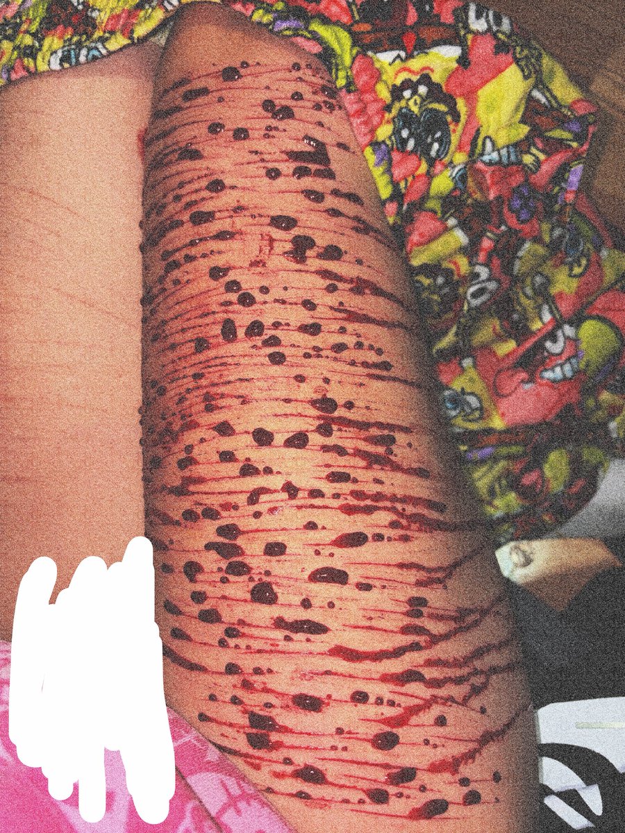 Nina23964485058's tweet photo. Okguys look at this sfx makeup i did for halloween! ALL FAKE NOT REAL ⚠️#shtwt #ouchietwt #sfx #makeup #halloweenmakeup #halloween https://t.co/XwfrL6C1pJ