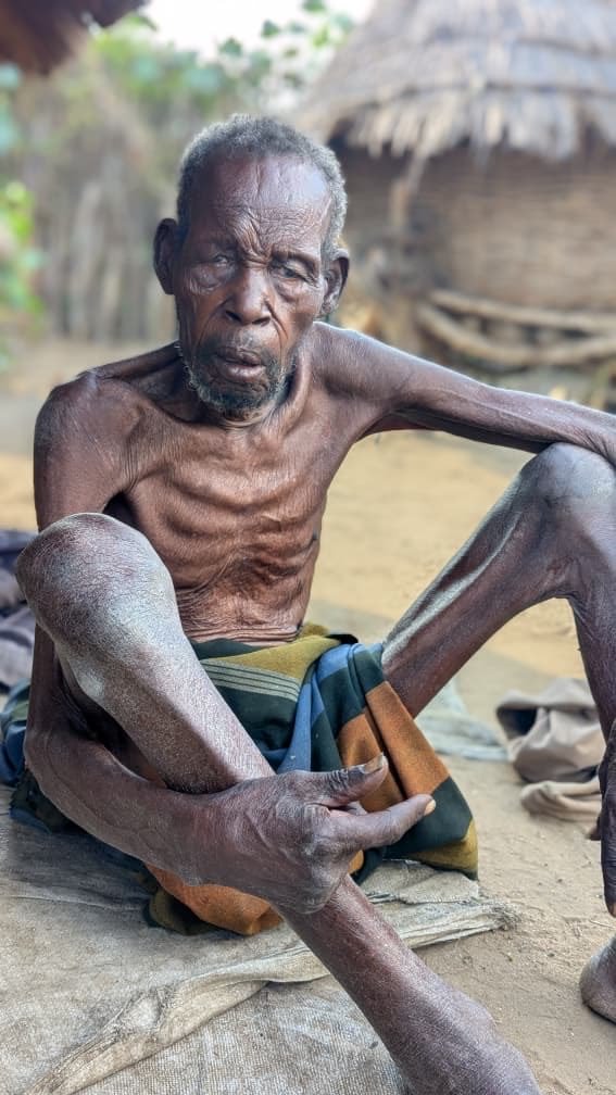 CADuganda256's tweet photo. Karamoja is bleeding. Drought, hunger &amp; water scarcity worsened by fossil fuels &amp; deforestation, yet govt pushes EACOP.
We demand: Water systems for Karamoja, restoration of forests, clean energy, not oil pipelines.
Karamoja deserves climate justice. #SaveKaramoja
@StopEACOP https://t.co/dXDyWRC9Ur