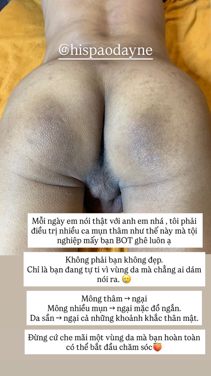 hispahealthy's tweet photo. ĐIỀU TRỊ THÂM MÔNG , ASS ib ngay để được tư vấn và hổ trợ 

☎️ ZALO : 0938894485 https://t.co/hRzENEkgaW
