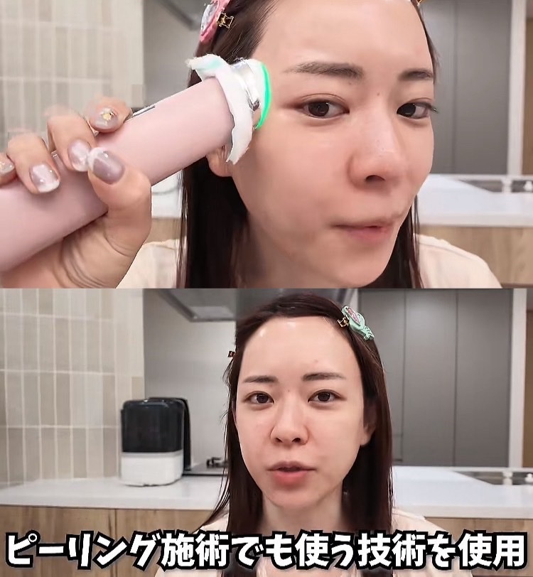KashifM55937101's tweet photo. 流石に皮脂取れすぎでくさ。美顔器も流石に気まずい。 https://t.co/M9XAUbr3uY