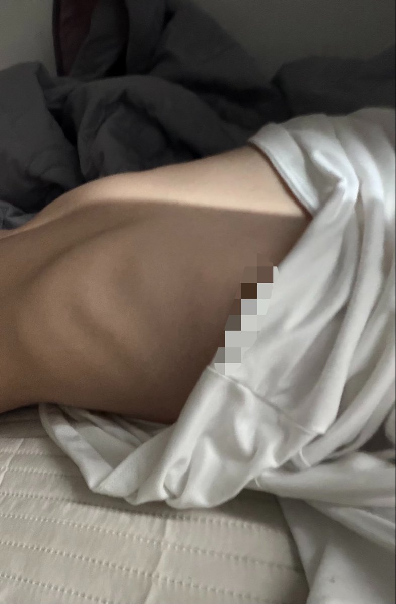 lanadoerey's tweet photo. bmi17 (84lbs) today ^^ https://t.co/jGOnZdWn1e