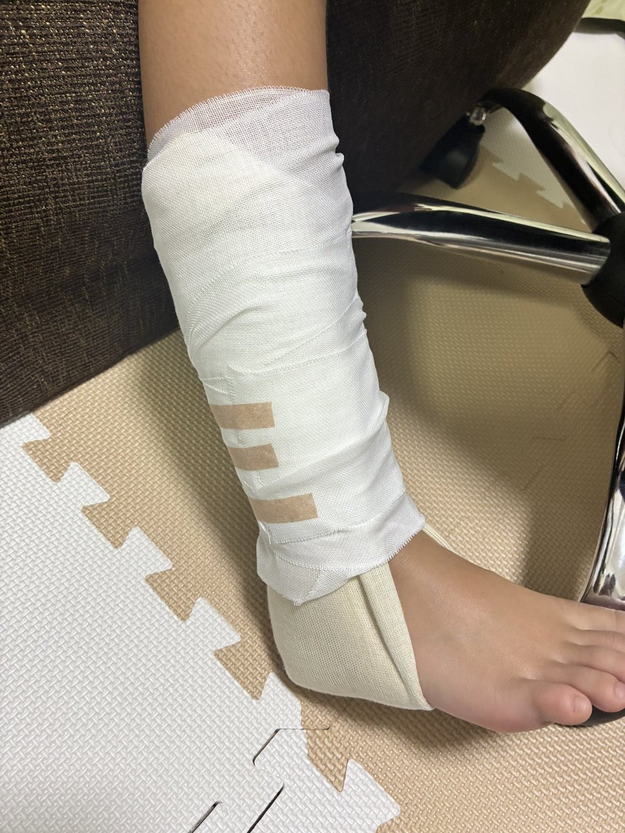 akarui_happano's tweet photo. シャワーのあと娘の包帯巻き直し。
やっぱり看護師さんみたいにパリッとはいかないけど、固定できたからよしとする。
病院では巻き方を丁寧に教えてもらったからなんとかなりました、感謝🙏 https://t.co/ZpTsWgb5MO