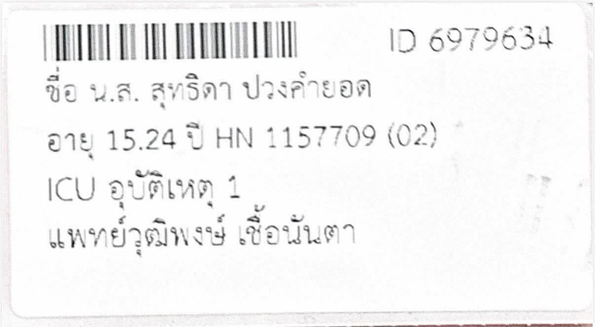 gujabra's tweet photo. #รับบริจาคโลหิต ให้นางสาว สุทธิดา ปวงคำยอด ประสบ #อุบัติเหตุ|รถชน..ได้ทำการผ่าตัดสมองตอนนี้ต้องการเลือดจำนวนมาก สามารถบริจาคได้ที่โรงพยาบาลทุกแห่ง  บริจาคแจ้งบริจาค ให้นางสาวสุทธิดา ปวงคำยอด ตอนนี้รักษาตัวอยู่ที่ icu โรงพยาบาลเชียงรายประชานุเคราะห์ 
ขอบพระคุณทุกคนมากคับ https://t.co/XEfhrrbSYN