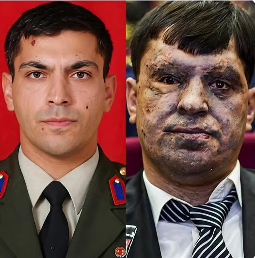 NUH_Kemal_'s tweet photo. "Allah'tan bana oldu, neferlerime bir şey olmadı"
Jandarma Binbaşı Mehmet Bedri Aluçlu
28 Ekim 2007 Siirt
Bugün Mustafa Kemal'e TBMM tarafından “gazi” unvanı verildiği gün… 
UTANMASI GEREKENLERİN BİR GÜN UTANMASI UMUDU İLE!
#GazileriminYanındayım https://t.co/jwtHZ8vtOq