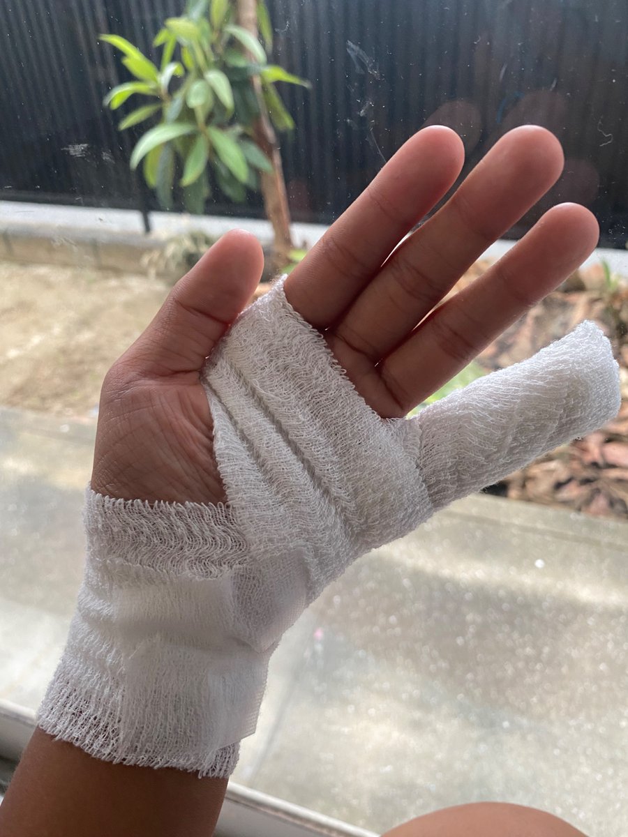 ddqvwc's tweet photo. いえーい✌️
……
うわぁぁぁん……!!
あのですね。女子ソフトボールしてるんですが、キャッチャー練習してたら、左小指が痛くって……😭しました。なんと……ひびが入ってました。2週間後は1年生だけの新人戦と言うことがあるのに……!!😭ﾀﾋぬ……😭
痛い😭😣 https://t.co/Lt5BPGN7bi