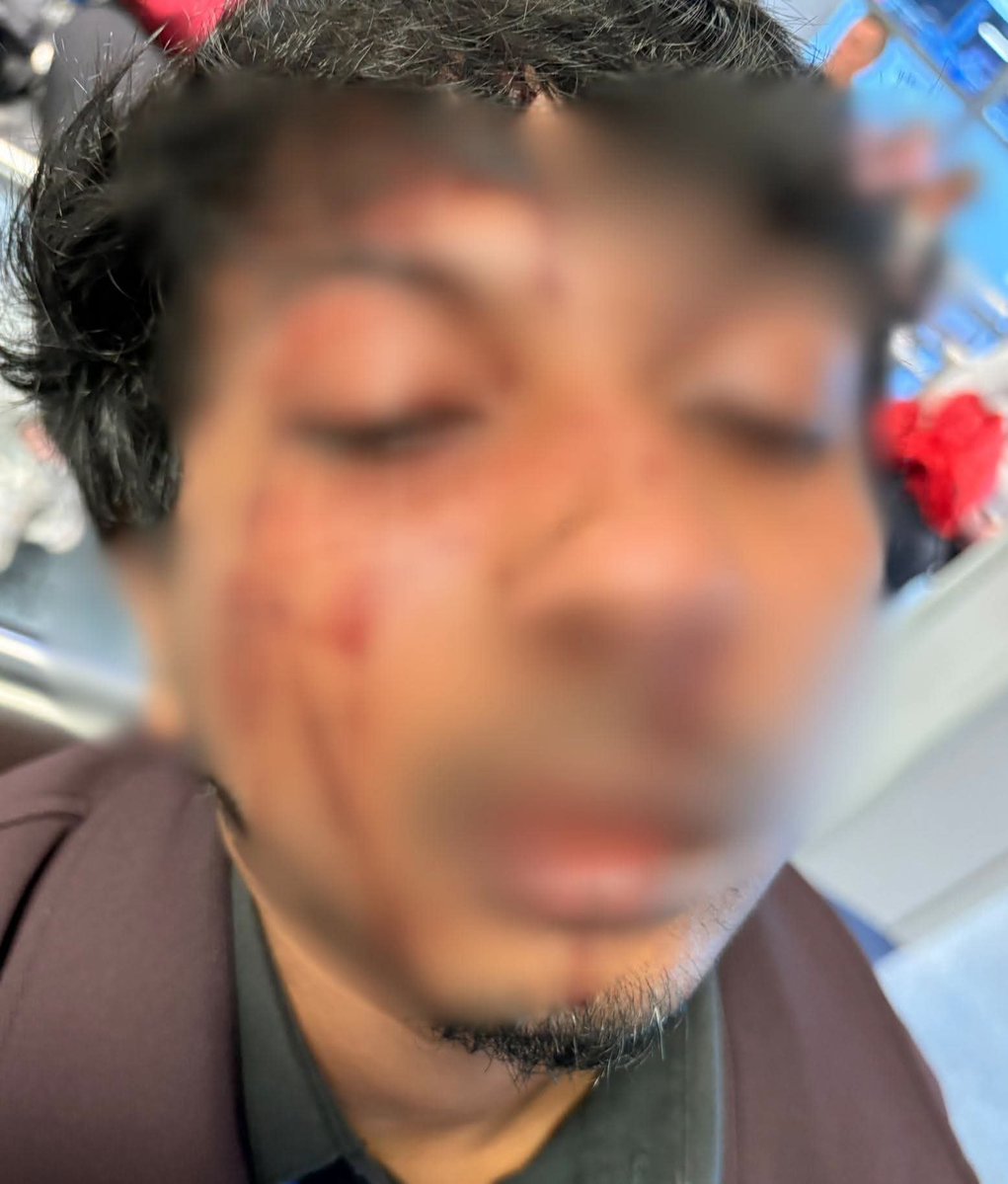 doamuslims's tweet photo. A Bangladeshi man desperately "shouted for help but nobody came" after he was repeatedly punched by a "racist" thug in Glasgow city centre. 

Iftekhar Ul-Islam says he tried his "hardest to stay alive" during the frightening ordeal on Wednesday morning. He was approached by a Scottish man, unknown to him, who asked for a cigarette.

Moments later, the thug, described as being "well-dressed", came close to Iftekhar and became "aggressive". He says that he attempted to move out of the way but the thug "grabbed my backpack from behind".

Iftekhar continued: "He said “I want to beat you”" 😡

Source: Glasgow Live
