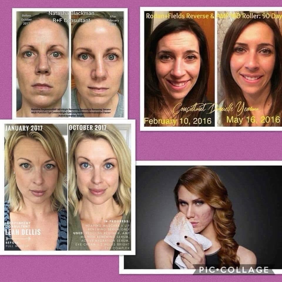 CyrusComeguooc's tweet photo. At the end of the day, when your makeup comes off, are you happy with your skin? My mission is to help you say yes. Address the root of issues like sun damage, sensitivity, wrinkles, acne, dullness, and texture with clinically proven products—not https://t.co/HOnVmz4CMk