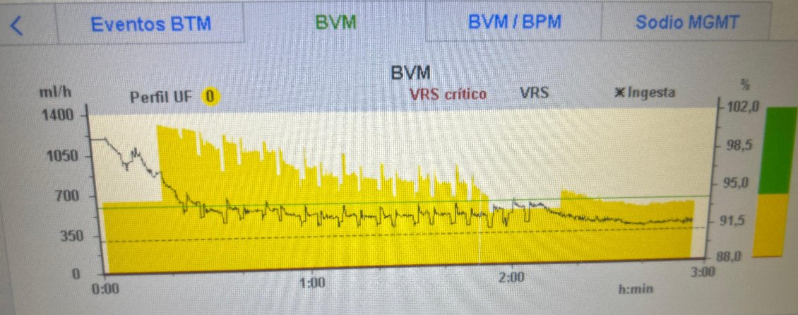 NefroGetafe's tweet photo. 🤔¿Conoces BVM® de Fresenius?
👉🏼Estrategia 2:
📌Establece VRS crítico 90%
⬇️Ve disminuyéndolo según:
   1. Tolerancia😵‍💫 
   2. Si con la UF no se llega a objetivo🏁
📈📉La tasa de UF alternará fases de subida y bajada
✅😄Menos hipotensiones
@SENefrologia @SOMANEorg @FME_Global https://t.co/mVDcpICo5h