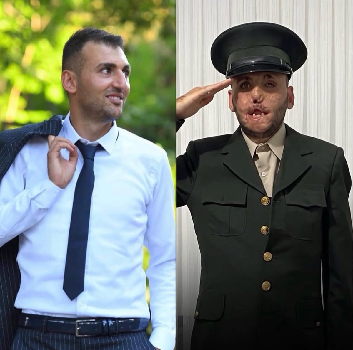 uzmancavustr's tweet photo. 2020 yılında Türk Silahlı Kuvvetleri’nin Irak’ın kuzeyindeki Pençe-Şimşek Operasyonu sırasında görev yapan askerlerimizden biri olan Yusuf Yolcu, bir EYP (El Yapımı Patlayıcı) patlaması sonucu ağır yaralandı. Patlama yüzünde ve vücudunda ciddi hasara yol açtı, gazilik mertebesine erişen Yusuf Yolcu’ya sonsuz saygı ve sevgilerimizle.
Hakkınız ödenmez!

19 Eylül Gazilerimizin günü kutlu olsun haklarınız asla ödenmedi, ödenemez . . .

#19eylülgazilergünü #uzmancavus #UzmanÇavuş #gazilergünü #gazilergünükutluolsun