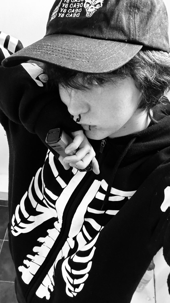razorrozary's tweet photo. @THERECKONlNG Me and my ‘horrible cystic acne ridden skin’ after 2 years on T oh woe is ME https://t.co/JiLbINl5Tx
