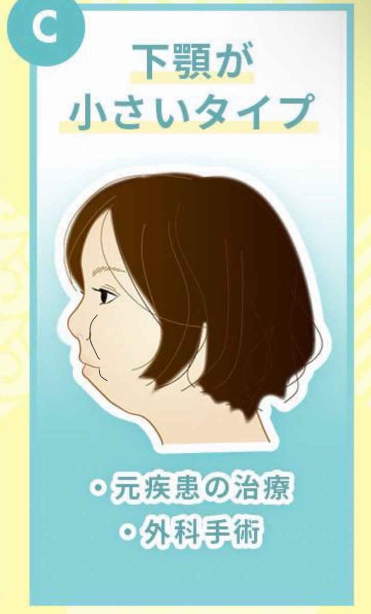 0106hs's tweet photo. Cタイプで整形で救われた人っている？

私Cタイプなんだけどまじで伸び代感じない

Cタイプって実は顎の小ささだけじゃなくて、
横から見た時の頬の丸み、
鼻が短くて小さい
とかも併発しがちだと思うんだよな
これがもう厳しい

整形で救われるのってAかBのイメージ https://t.co/neS2HSsFA8