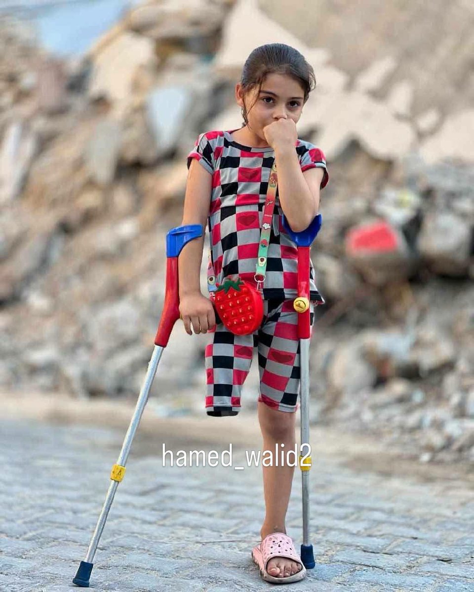 ahmedshameya995's tweet photo. She's 8 years old, and she lost her leg in Gaza.

She had dreams. https://t.co/vBWLLPmGsQ