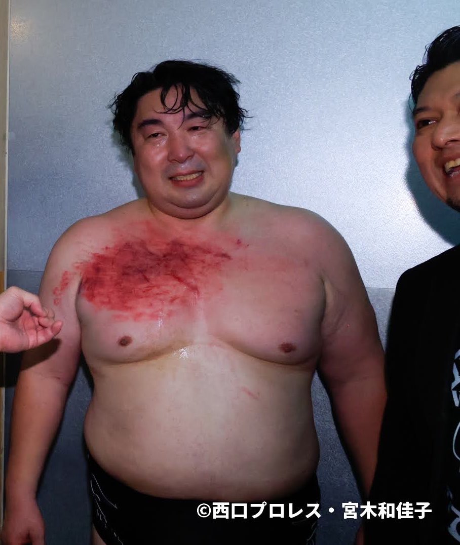 F_kobashi_sma's tweet photo. @sameman05 エンタメで片付けてる人達、プロレスラーにやられたらこうなるよ。
マンちゃん、プロレスは面白い！だね！！ https://t.co/GNzGJyWI6j