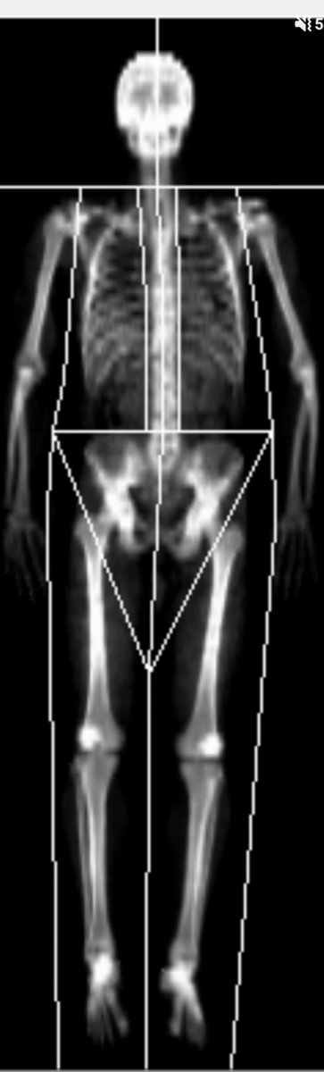 Velion's tweet photo. This is my skeleton. https://t.co/fErhowRZZ8