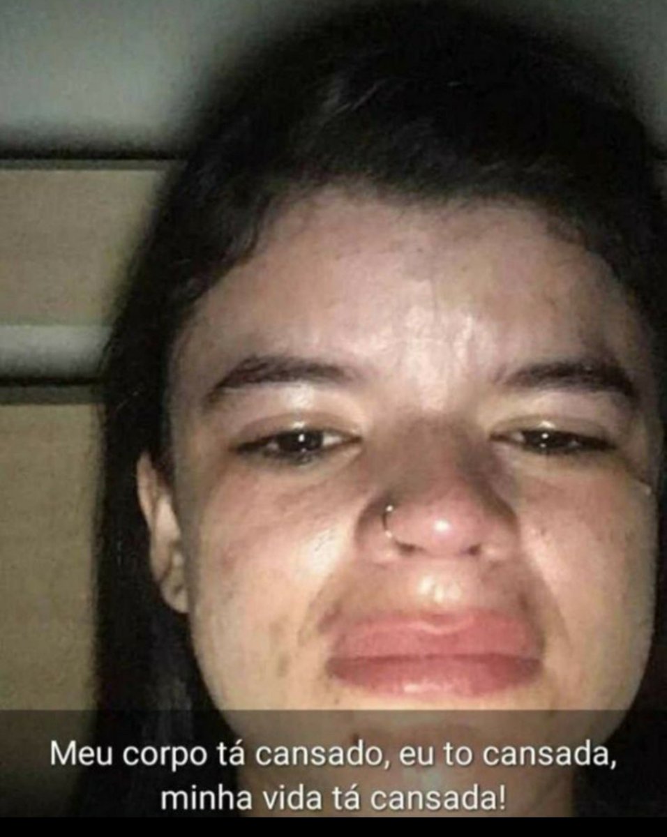 rob_ert354's tweet photo. não tem como criar um creme ou remédio que acabe de vez com todo o acne independentemente do seu tipo de rosto???❌💔 https://t.co/CdUtkUzSTP
