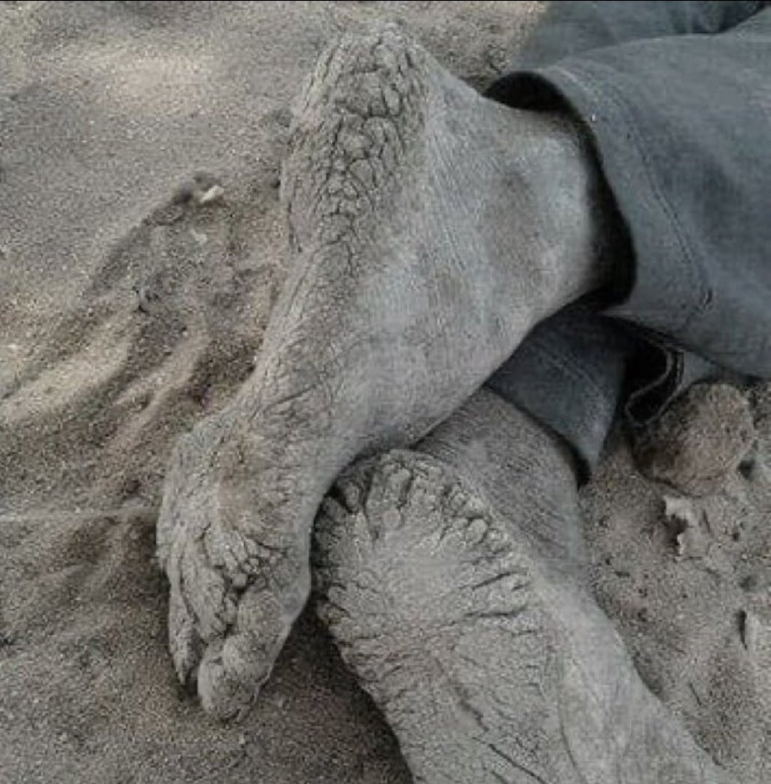 ros_sara2002's tweet photo. These are not just feet covered in dust. These are the feet of a Sudanese person who walked for miles to escape death, but death was faster 💔 https://t.co/UKRg2aD50e