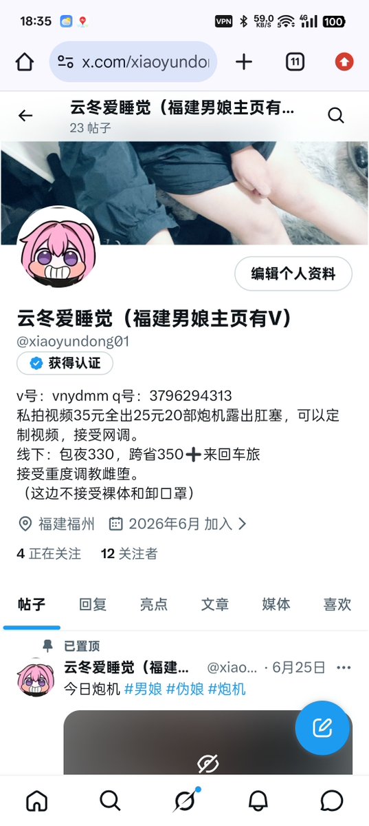xiaoyundong01's tweet photo. 有主人需要玩弄母狗吗，线上线下可月主页无门槛可➕V，出私拍视频，喜欢可以关注后续更新滴蜡调教 https://t.co/3wFd46LXqa