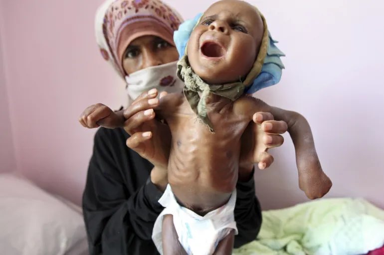 _Mui_9's tweet photo. هذا ما فعّله الحوثي في اليمن 🇾🇪 

#Yemen #Houthis #ChildrenOfYemen https://t.co/8oouiMzygL