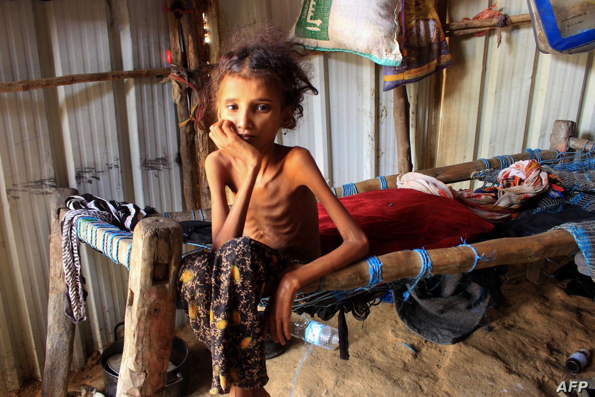 _Mui_9's tweet photo. هذا ما فعّله الحوثي في اليمن 🇾🇪 

#Yemen #Houthis #ChildrenOfYemen https://t.co/8oouiMzygL