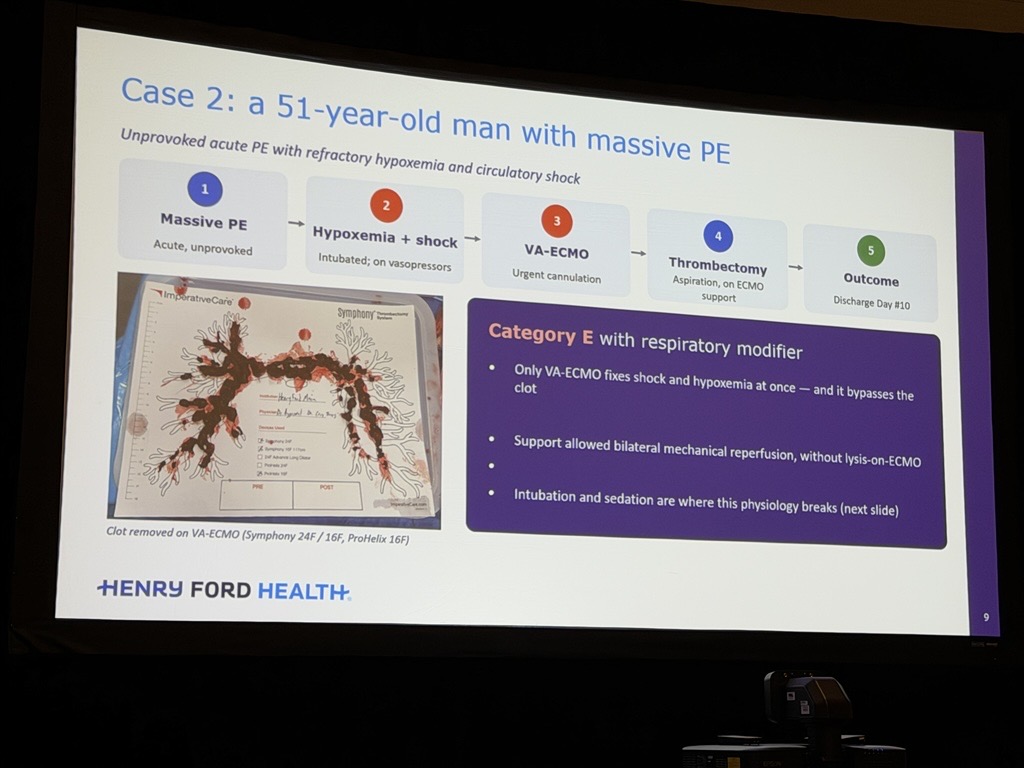 SCAI's tweet photo. @SripalBangalore @BurkhoffMd @sanjum @VikasAgarwalMD How can MCS help unload the right heart in PE-associated shock?

Vikas Aggarwal, MBBS, FSCAI, explores the role of mechanical circulatory support in this high-risk setting.

#SCAISHOCK @SripalBangalore @BurkhoffMd @sanjum @VikasAgarwalMD https://t.co/zzYCz61V7U