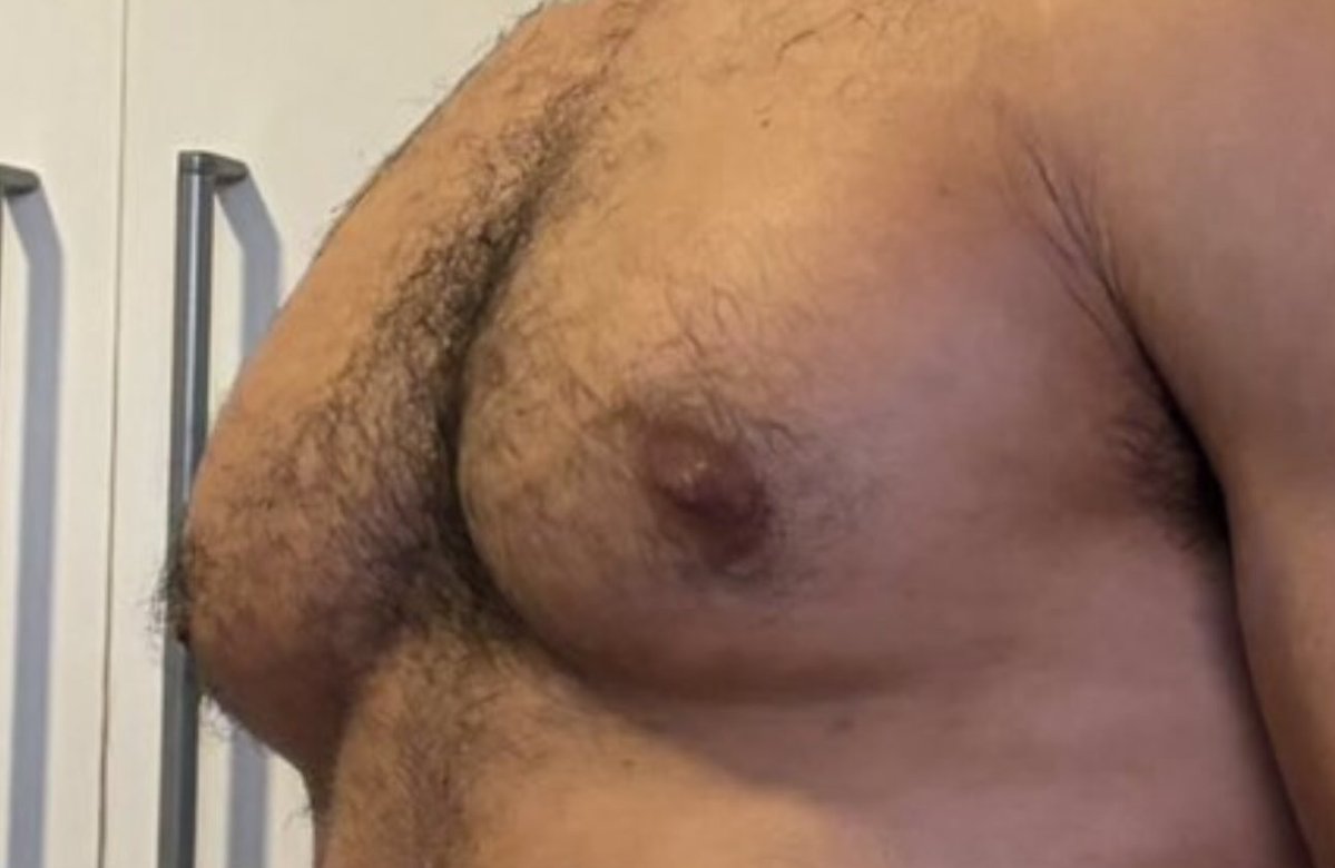 porcarelaxada's tweet photo. @igorgomms as pessoas acham que podem sair por aí se apropriando da ginecomastia alheia? https://t.co/JDZCivAOQv