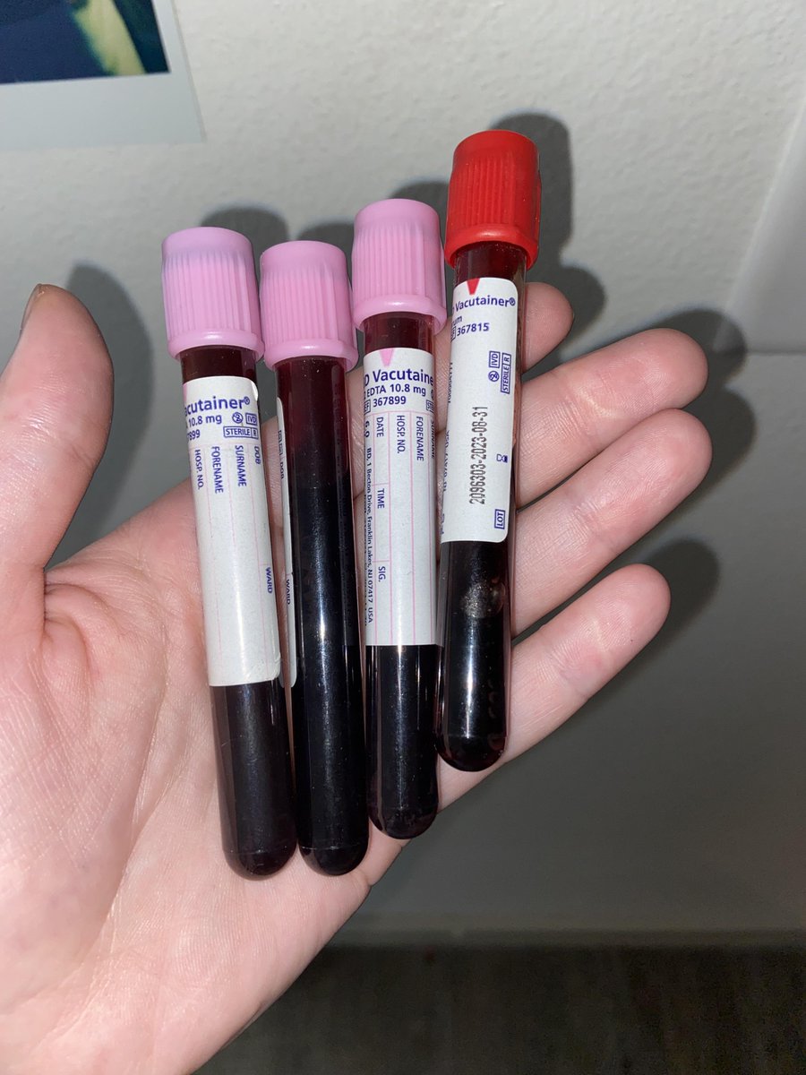 DumbLumiThing's tweet photo. Sometimes I lie to patients about how much blood needs to be taken so I can keep some for myself for my blood collection https://t.co/TI0ytTGgFp