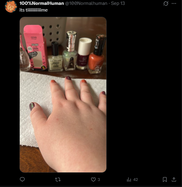 PInchyMac's tweet photo. @100Normalhuman @TearingJester @orangesrnice1 @Emmafromtwt im surprised those absolute stampers were able to type out these responses in such little time, also i wasnt even talking to you but apparently i hit the nerve that broke your fragile twitter artist ego https://t.co/AH0uDivX9D