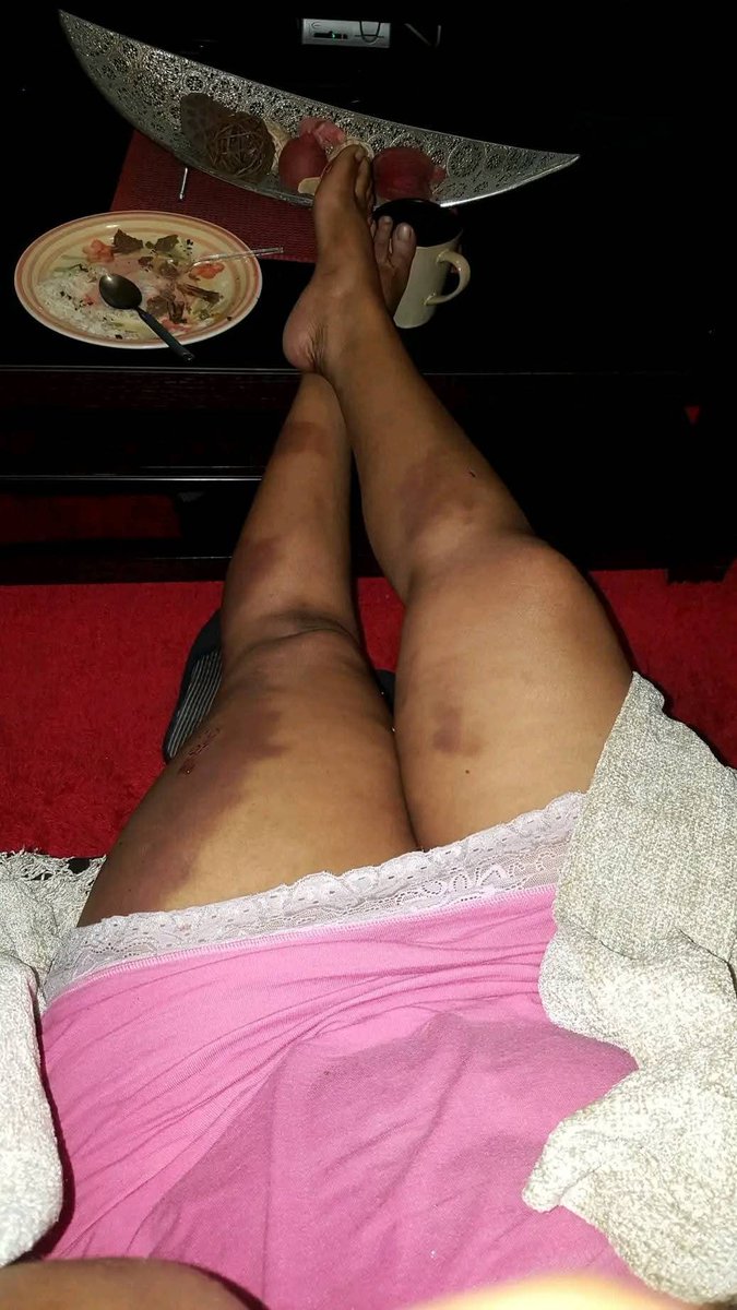 Maka_Sonie's tweet photo. Remember Namhla Mthwa, she was shot 9 times at Mthatha in broad daylight and her alleged killer was a tenderpreneur.... Her case went cold she never got justice 😔
#LawrenceChamurwaMudzinganyama https://t.co/IYKE49Xbgg