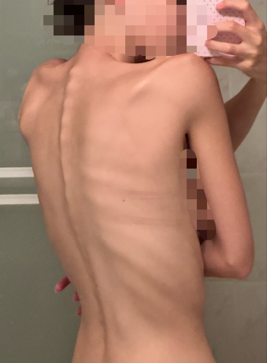 areyoudoll's tweet photo. so disgusted with myself https://t.co/VrXDYv3TBq
