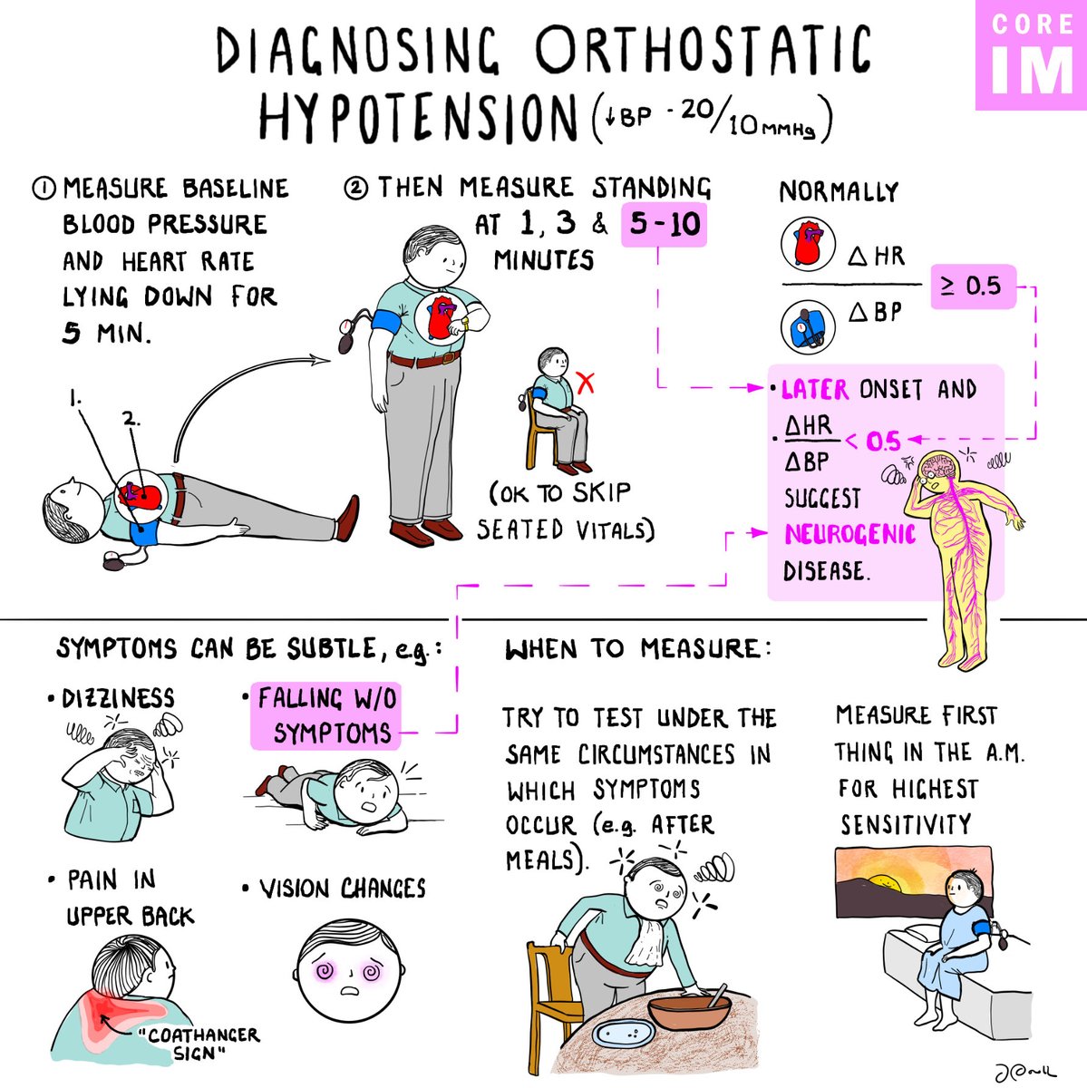 md1talk's tweet photo. Orthostatic vitals

الطريقة اللي نبغاها هي كالاتي:
- يستلقون خمسة دقايق، ناخذ الضغط وهم Supine
- وبعدها ناخذ الضغط وهم واقفين بعد دقيقيه، ومره ثانية بعد٣د (مو على طول اول ما يوقفون!)

تفاصيل بسيطة تفرق بالتشخيص! https://t.co/FQvYmEbX1K