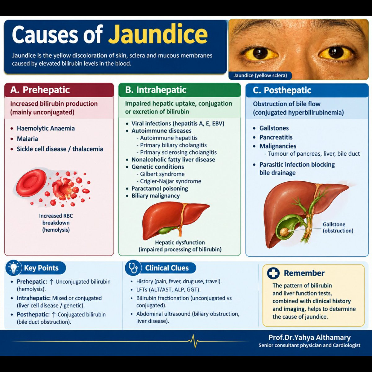 DYahya19's tweet photo. #Causes_Of_Jaundice https://t.co/b62yfcjF3r