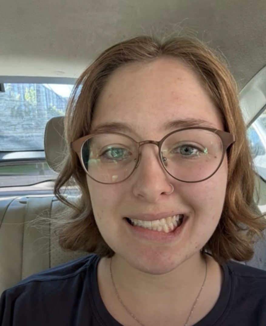 Danrey_98's tweet photo. @Altamash_io @kyliebrewer_ Facts dude fuck this cunt, Iv heard a lot of shit about her. My favorite one was when her face looked like this due to stress with online hate supposedly. But yet she has no problem promoting hate herself make that make sense. 🤣🤣🤣 https://t.co/PHeKVX6v3J