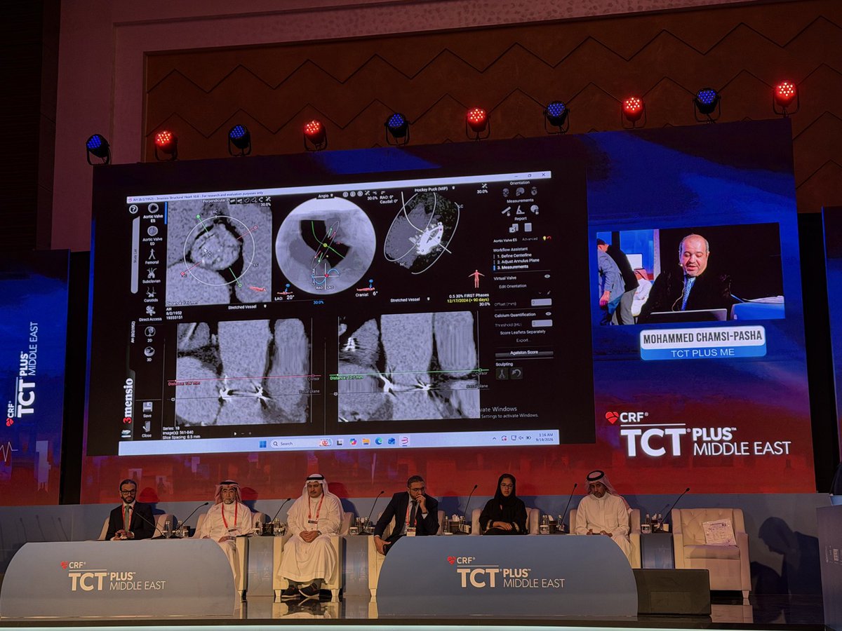 ChamsiPash's tweet photo. Congratulations to a monumental conference @TCT_ME_ @crfheart , where advanced knowledge, enhancing skills and great engagement from outstanding high caliber faculty make this a huge success, second year in a row , thanks @mirvatalasnag @drptca @AlkashkariWail and @mmamas1973 https://t.co/aKNAGV0Ld5