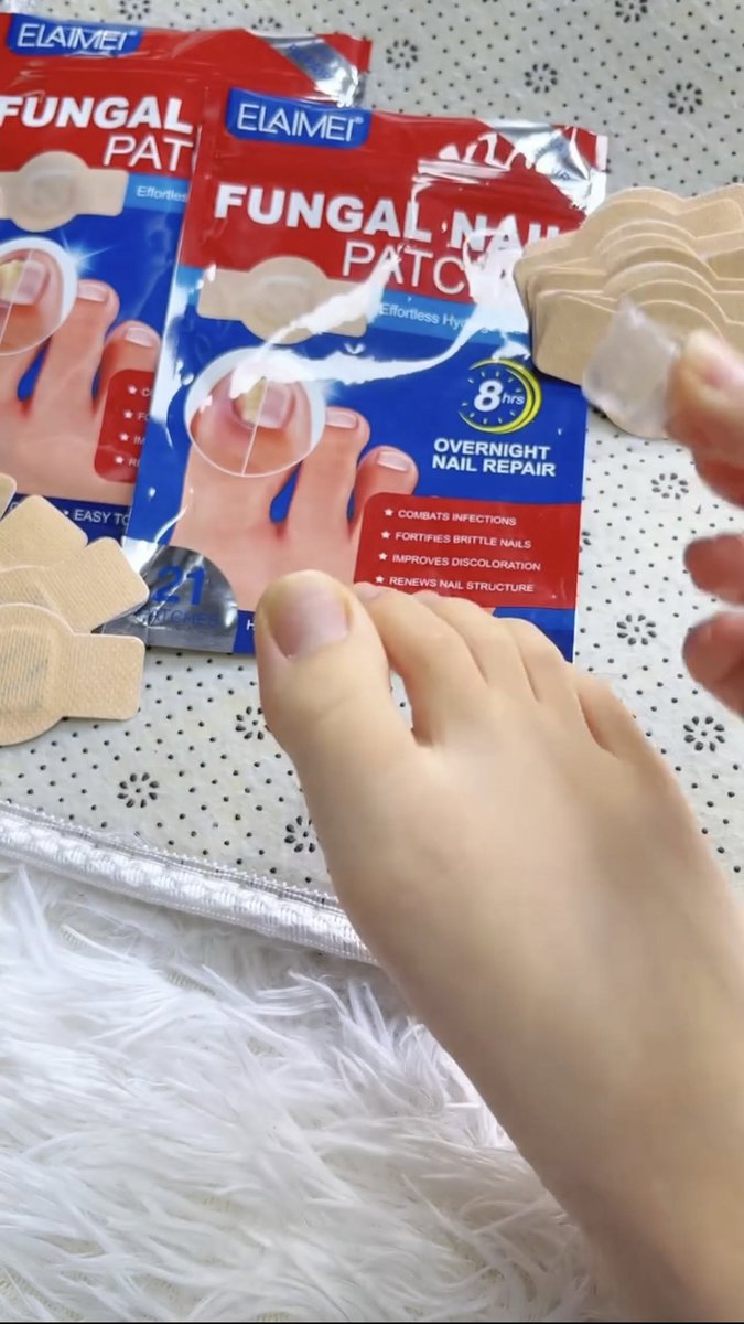 xoxonab12's tweet photo. Patch ini bikin jamur di kuku terhempas, tinggal di pakai saat mau tidur semalaman paginya udah berkurang deh 👇

https://t.co/pE47BSnYFj
https://t.co/pE47BSnYFj https://t.co/SP8MuNzGKQ