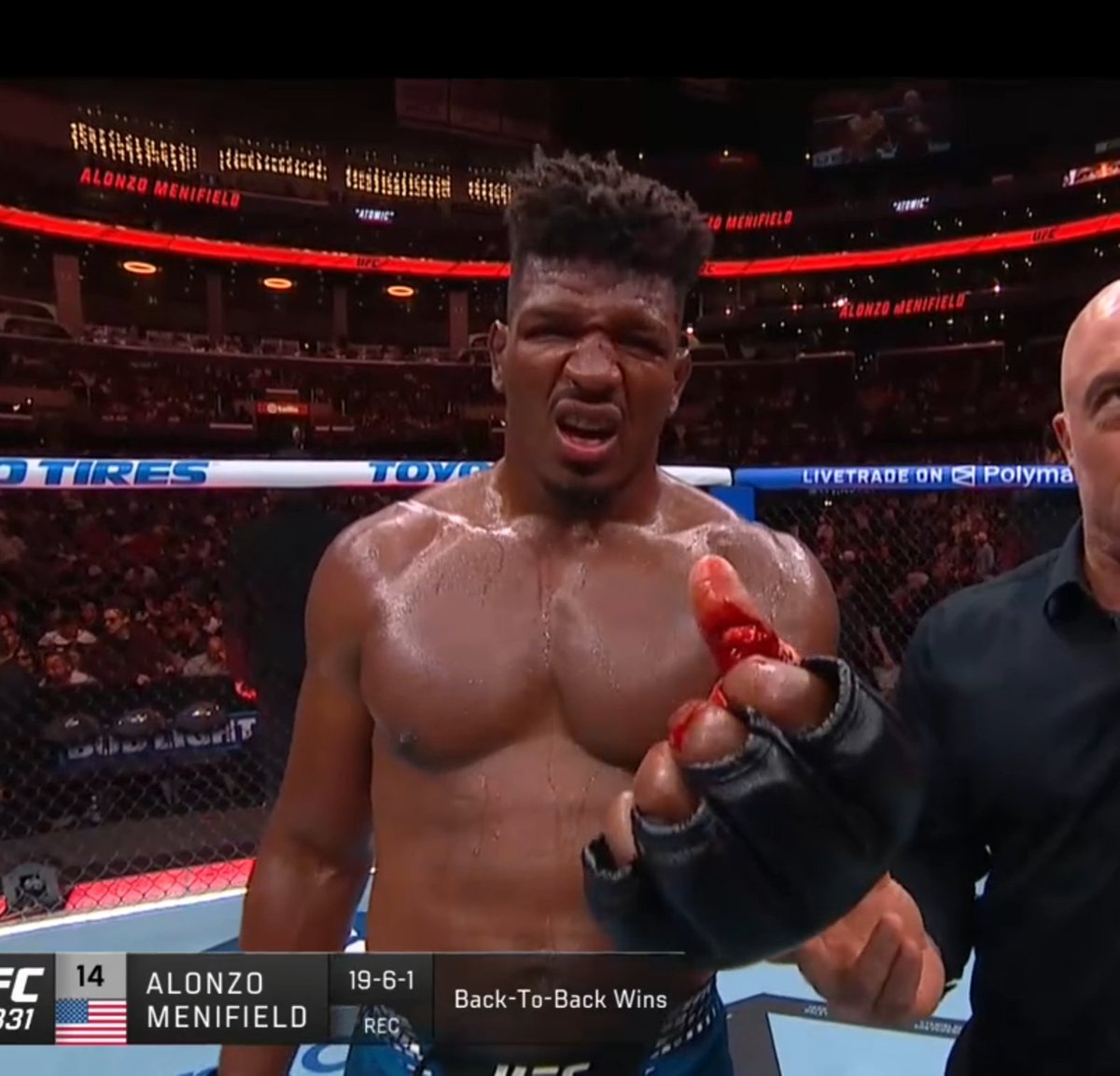 MMAJOEYC's tweet photo. HOLY FUCKING SHIT!!!!! MENIFIELD THUMB IS FUCKING INSANE!!!!!! SOME GUYS WOULD CRY ABOUT THIS FOR A YEAR &amp; VACATE A TITLE OVER IT https://t.co/gWg2WwiLGQ