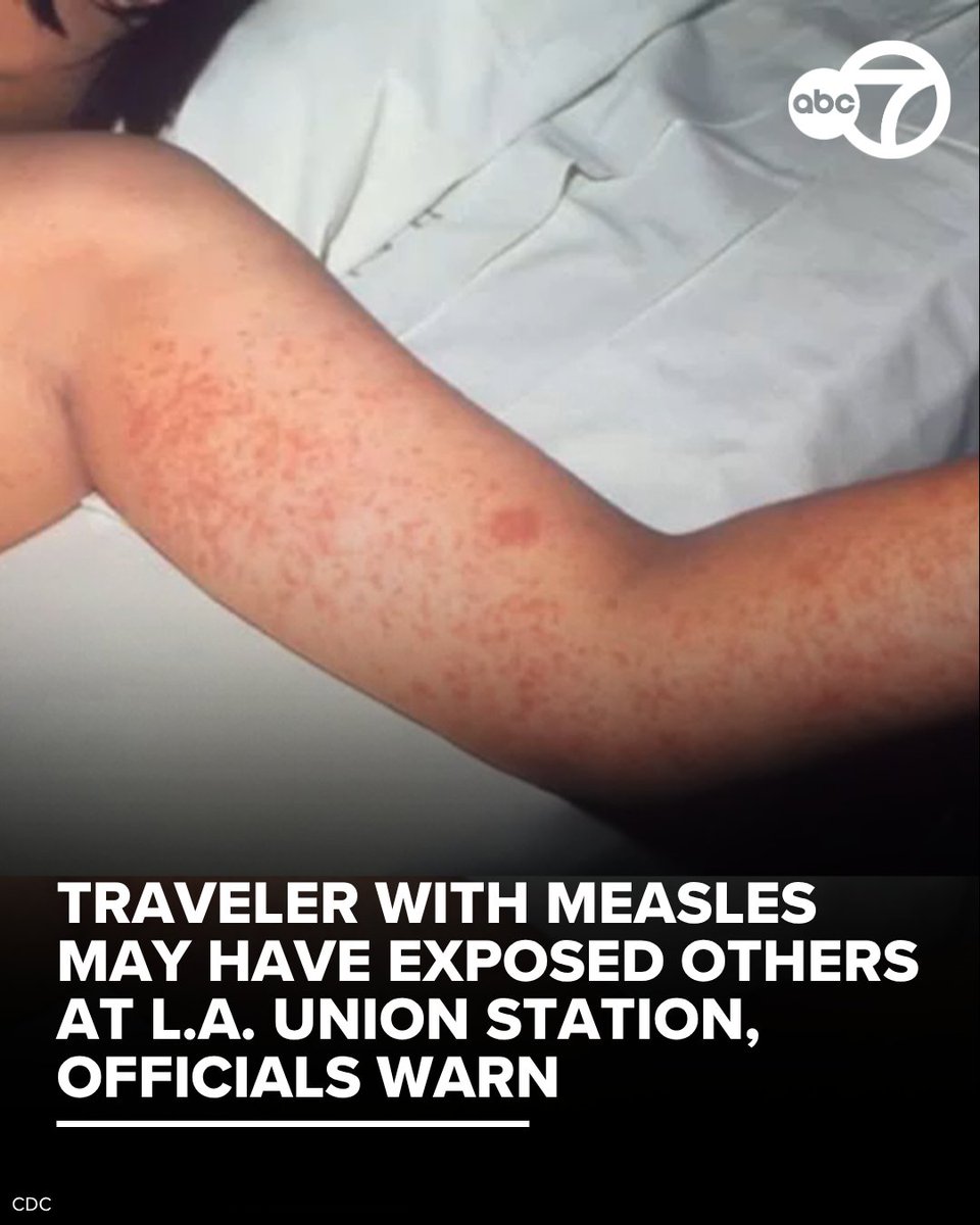 ABC7's tweet photo. Los Angeles County health officials warned that people who were at Union Station during a four-hour period last weekend may have been exposed to measles by an infected train passenger. 

Measles spreads through the air when an infected person breathes, talks, coughs or sneezes. Common symptoms include fever, cough, runny nose, red and watery eyes and a rash that typically develops three to five days after other symptoms. https://t.co/aO8M9H3V9o
