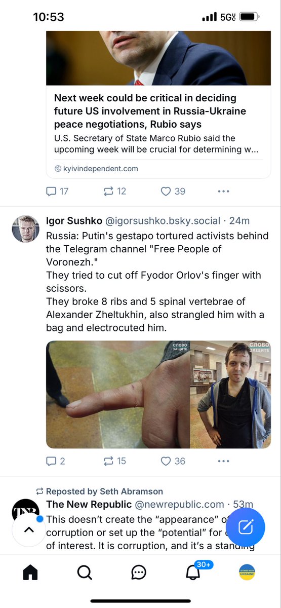 SteelCity__88's tweet photo. @OutFrontCNN @Kasparov63 Now do the same thing with Ukrainian pows. Should show them in the same clip. https://t.co/cvt4dCKgIG