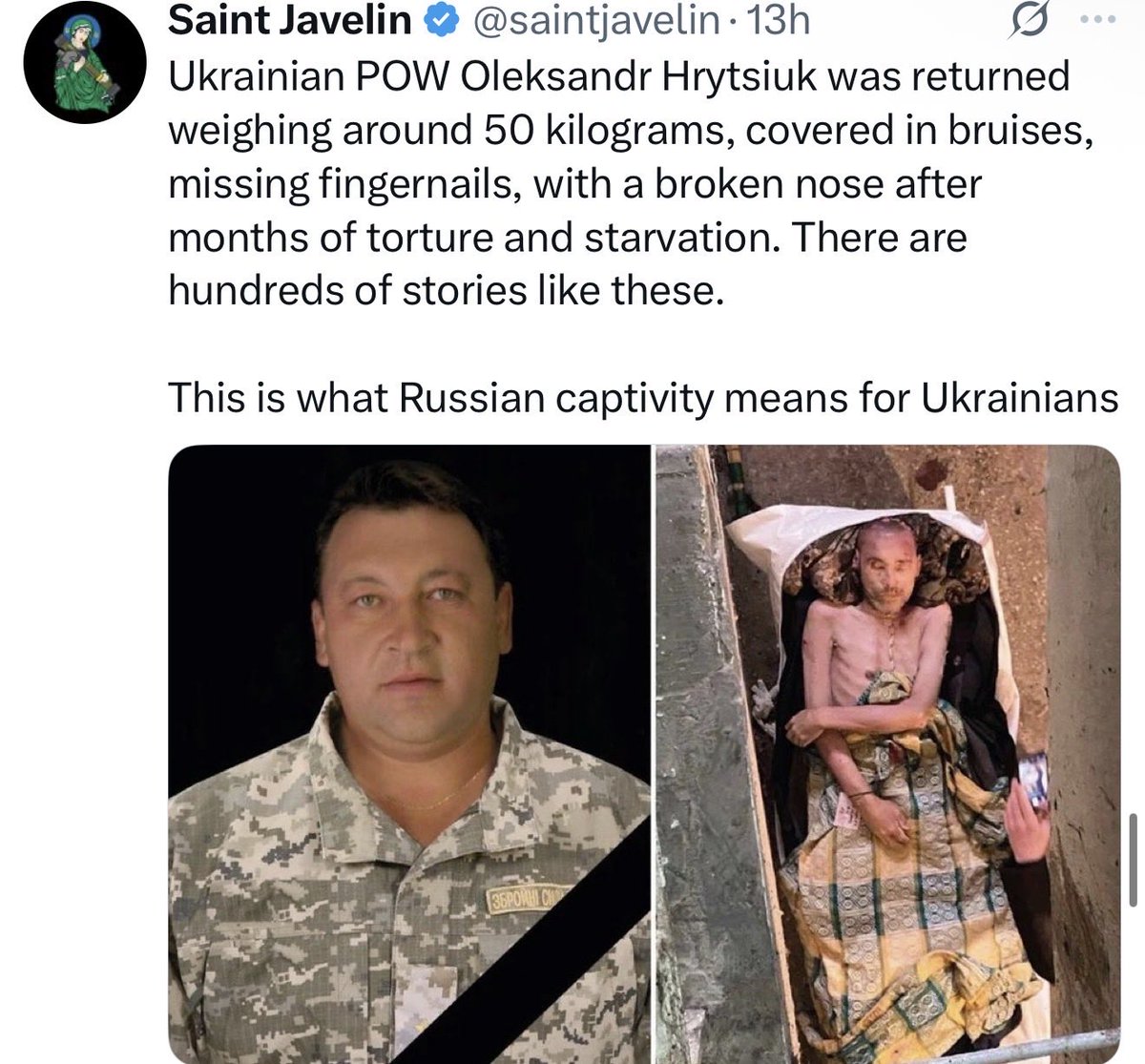 SteelCity__88's tweet photo. @OutFrontCNN @Kasparov63 Now do the same thing with Ukrainian pows. Should show them in the same clip. https://t.co/cvt4dCKgIG