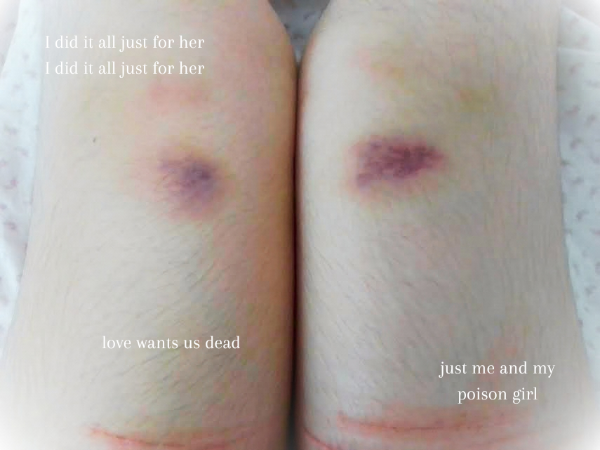 helpidontknowww's tweet photo. I was too lazy to edit it better, I'm sorryy 
[All sfx makeup enhanced by AI] #sh #shhtwt #bruisetwt #bruise #bruising #ouchietwt https://t.co/EmTYfiqPOT