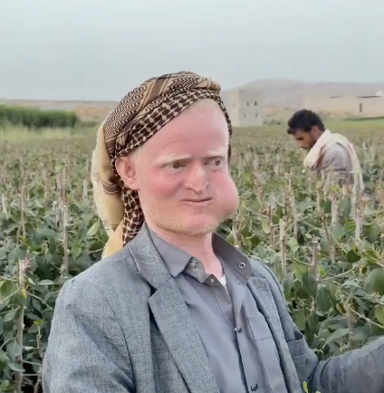 lionel_trolling's tweet photo. "you better not be chewing khat again"

me: https://t.co/79K3X5AjhY