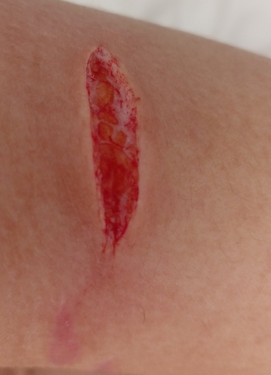 evaniscrazy's tweet photo. SFX MAKE UP ALL FAKE TRAINING IA FAKE BLOOD FAKE ARM EVERYTHING FAKE IM JUST GOOD AT MAKE UP AND MAKE IT LOOK MORE REAL WITH AI SO THIS IS ALL FAKE SFX MAKE UP WORK FOR HALLOWEEN FAKE FAKE FAKE TRAINING AI!!!
#slittwt #shttwt #shertwt https://t.co/IXDdtqbmir